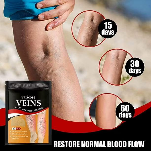 Varicose Veins Patch™ pack 3 PARCHES PARA VARICES )